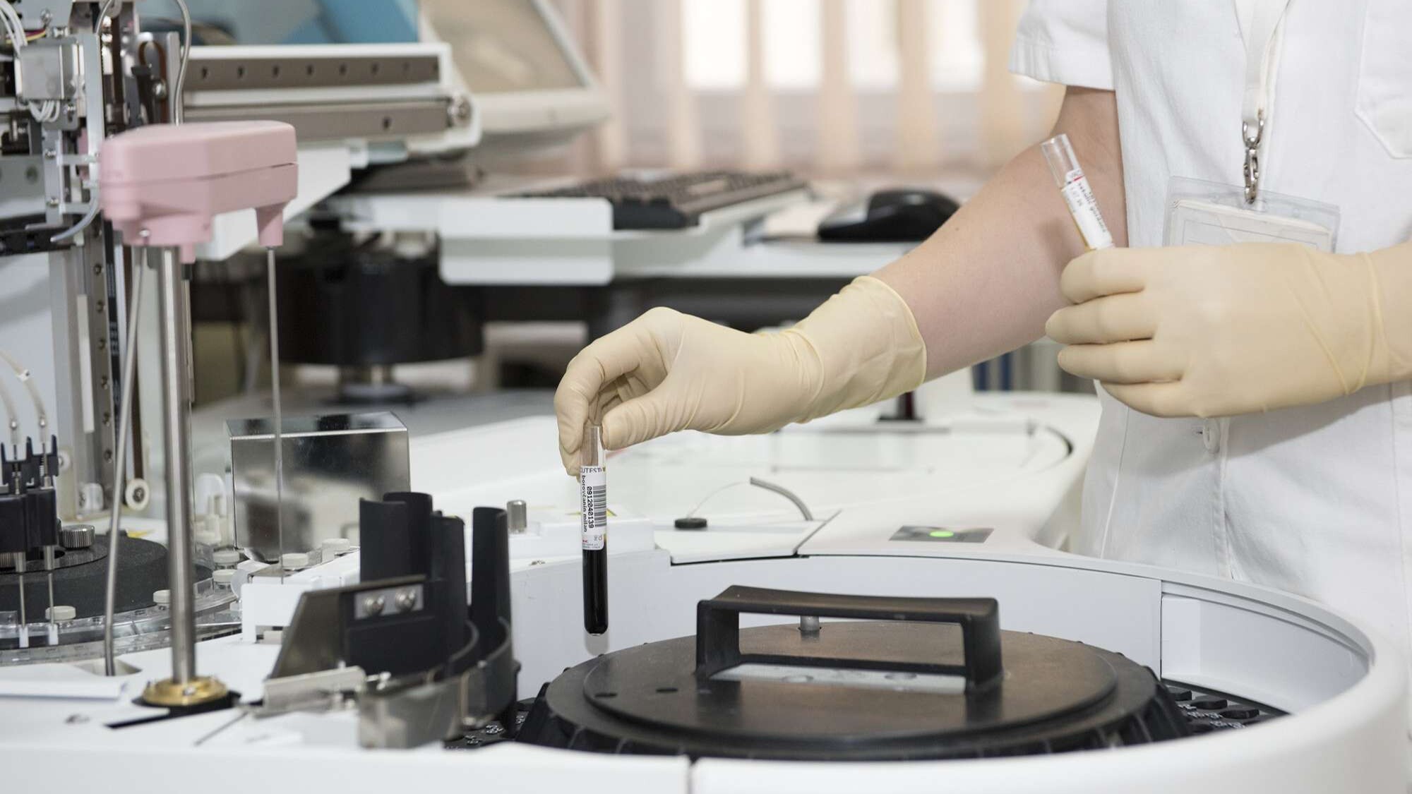 laboratory blood testing